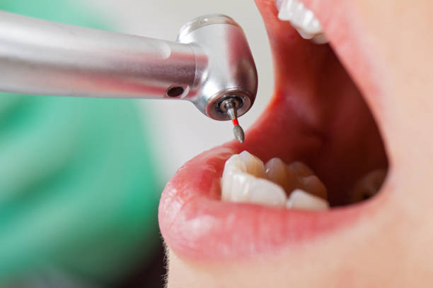 Best Emergency Wisdom Tooth Extraction in The College Of New Jersey, NJ
